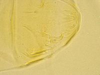 Echiniscus trisetosus image