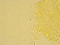 Echiniscus trisetosus image