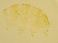 Echiniscus trisetosus image