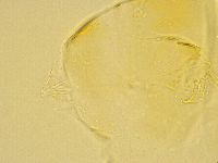 Echiniscus trisetosus image
