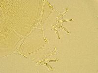 Echiniscus trisetosus image