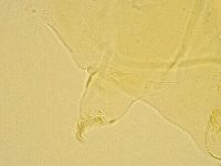 Echiniscus trisetosus image