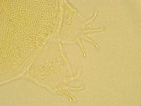 Echiniscus trisetosus image