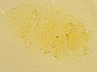 Echiniscus trisetosus image