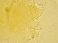 Echiniscus trisetosus image