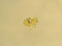Echiniscus trisetosus image