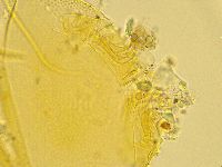 Echiniscus trisetosus image