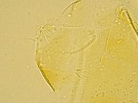 Echiniscus trisetosus image