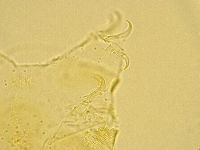 Echiniscus trisetosus image