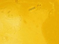 Echiniscus trisetosus image