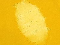 Echiniscus trisetosus image