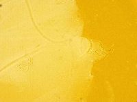 Echiniscus trisetosus image