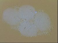 Echiniscus trisetosus image