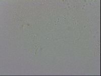 Echiniscus trisetosus image