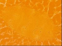 Echiniscus trisetosus image
