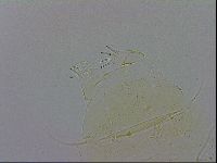 Echiniscus trisetosus image