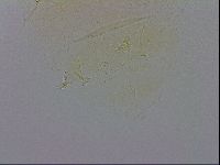 Echiniscus trisetosus image