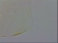 Echiniscus trisetosus image