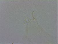 Echiniscus trisetosus image