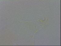 Echiniscus trisetosus image
