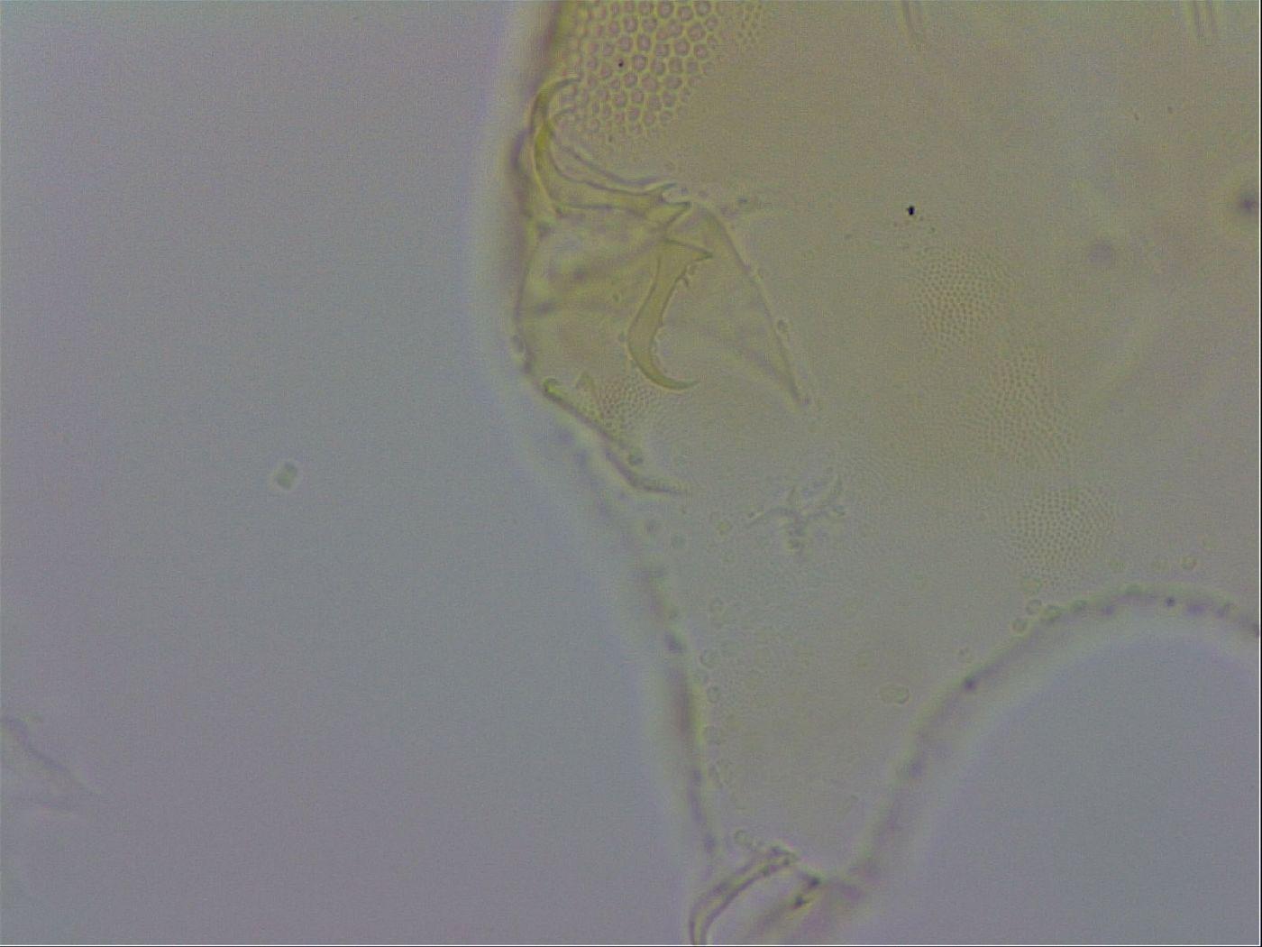 Echiniscus trisetosus image