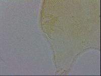 Echiniscus trisetosus image
