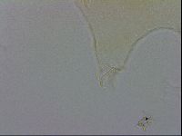 Echiniscus trisetosus image