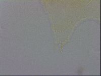 Echiniscus trisetosus image