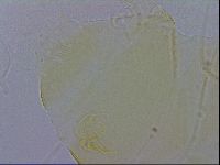 Echiniscus trisetosus image