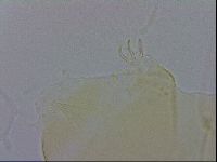 Echiniscus trisetosus image