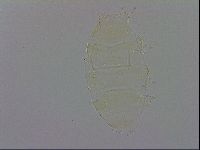Echiniscus trisetosus image