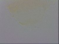 Echiniscus trisetosus image