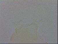 Echiniscus trisetosus image