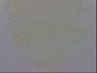 Echiniscus trisetosus image
