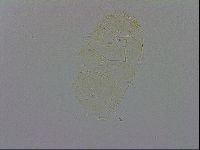 Echiniscus trisetosus image