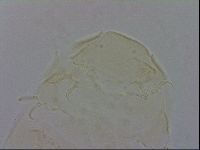Echiniscus trisetosus image