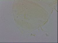 Echiniscus trisetosus image