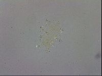 Echiniscus trisetosus image