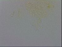 Echiniscus trisetosus image