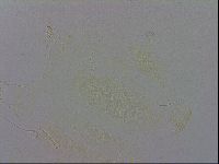Echiniscus trisetosus image