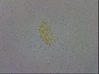 Echiniscus trisetosus image