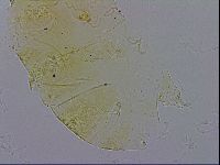 Echiniscus trisetosus image