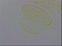 Echiniscus trisetosus image