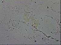 Echiniscus trisetosus image