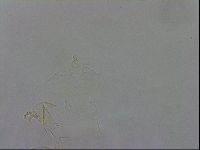 Echiniscus trisetosus image
