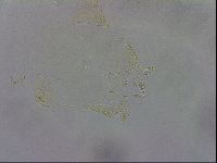 Echiniscus trisetosus image