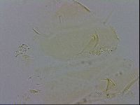 Echiniscus trisetosus image