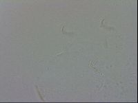 Echiniscus trisetosus image