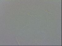 Echiniscus trisetosus image