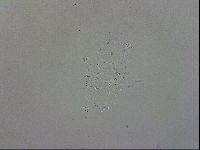 Echiniscus trisetosus image